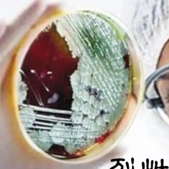 天花病毒的基本知识,汇集汇总一